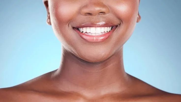 Healthy smile illustrating the benefits of proper oral care
